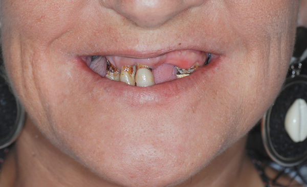 Clínica dental en Torrelavega